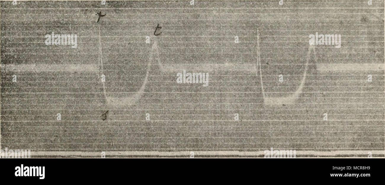 . Abb. 258. Aktionsstrom vom Bulbus aortae des Frosches. / Eiger. 1 de Meyer, Arch. Praktikant, de Figura 5, S.76; 1907; - Vgl. auch de Meyer, ebenda, S. 257; 1908; 10, S. 100; 1910. 2 Vgl. H. Straub, Zeitschr. f. Biol., 53, S. 507, 1910; - sowie Schneiders, ebenda, 65, S. 478 und 1915. 3 Eiger, Arch. f. d. Ges.. Kurt von Figura, 151, S. 19; 1913. 4 Eiger, ebenda, 151, S. 14. 5 Noyons, Onderzoekingen gedaan in het Kurt von Figura. Laborat. d. Utrechtsche Hoogeschool, 5. Stinkt, 11, S. 217; 1910. 6 H. Straub, Zeitschr. f. Biol., 53, S. 505, 518 und 1910. 7 Eiger, Arch. f. d. Ges.. Kurt von Figura, 151, S. 23; 1913. 8. Stockfoto