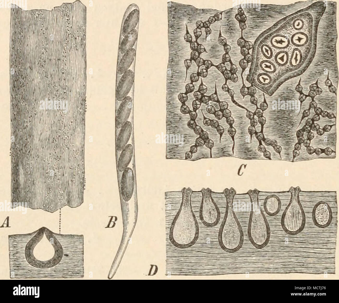 . Jugend außen mit conidienlragenden Haaren bedeckt ist. Fruclitkörper eingesenkt, dicht gelagert, mit den orig. Gfurchigen Mündungen vorragend. Außer den schon erwähnten Conidien, welche spindelförmig, hyalin, gekrümmt, 1 zellig Sindh, Pykniden kommen vor, welche aus länglichen, vielkammerigen Behältern bestehen, aus denen sterben Linealen, Top, dünnen gebogenen Conidien in Form dünner, roter oder goldgelber Ranken entleert werden. In Zweigen von Carpinus, Seltner in deren Geschichte Laubbäume in Europa weit verbreitet. Für Deutschland, speciell Westfalen, hut Nitschke noch eine Anzahl Arten nachg Stockfoto