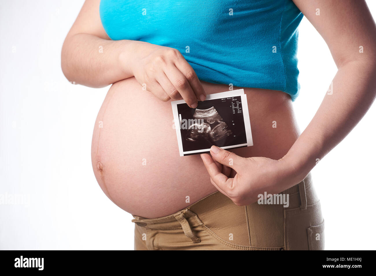 Seitenansicht der schwangeren Frau mit Ultraschall auf weißem Hintergrund isoliert Stockfoto