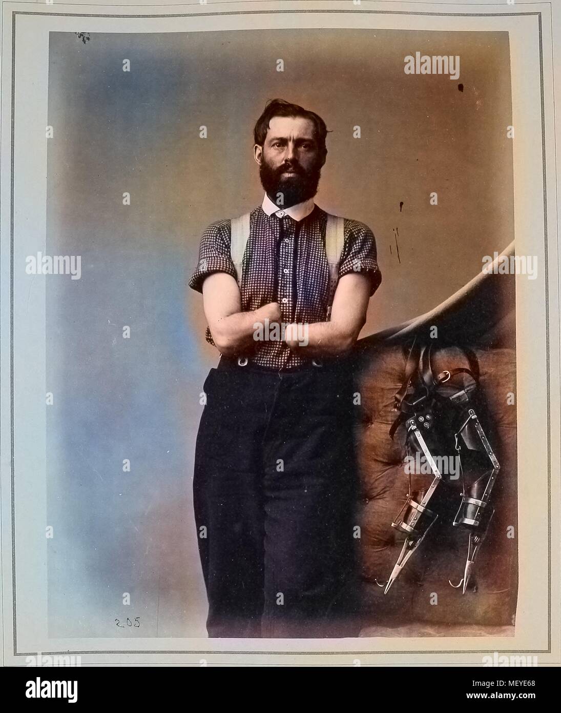 Foto aus dem Büro Veröffentlichung der US Surgeon General", Fotografien von chirurgischen Fälle und Proben,', doppeltes amputee, Privater Samuel H. Decker, Co. I, 4 U, 1865. S. Artillerie, und seine selbstgebauten Armprothesen. Mit freundlicher Genehmigung Internet Archive. Hinweis: Das Bild hat digital über ein modernes Prozess eingefärbt worden. Farben möglicherweise nicht sein - genau. () Stockfoto