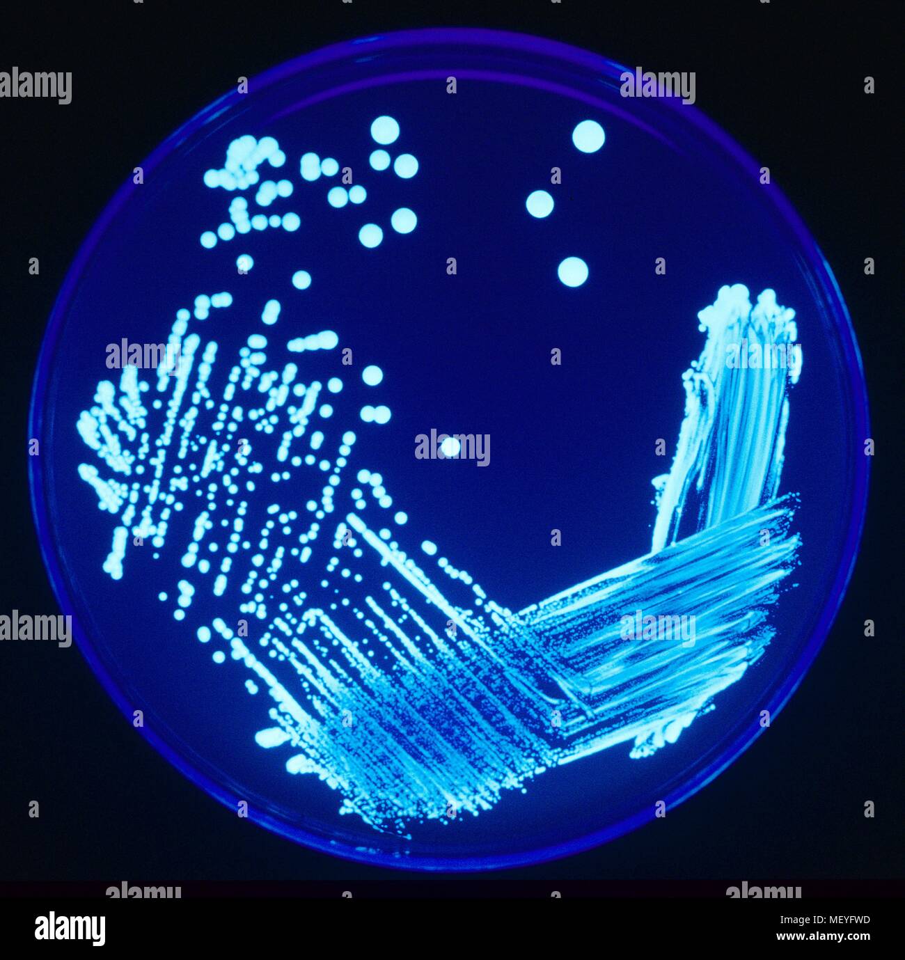 Legionellen Kolonien beleuchtet mit UV-Licht, auf einer Agarplatte 2005 kultiviert. Mit freundlicher Seuchenkontrollzentren (CDC). () Stockfoto