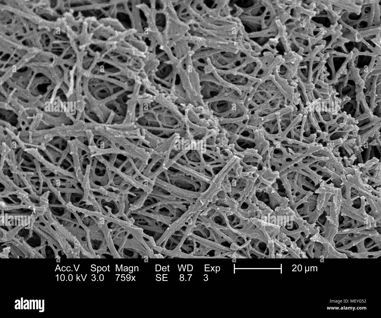 Morphologische Merkmale der inneren Oberfläche eines nicht identifizierten Vögeln Eierschale, in der 759 x vergrößert Rasterelektronenmikroskopische (SEM) Bild 2005 dargestellt. Mit freundlicher Seuchenkontrollzentren (CDC)/Janice Haney Carr, Sandra L. Westmoreland, an der Universität von Texas in Arlington. () Stockfoto