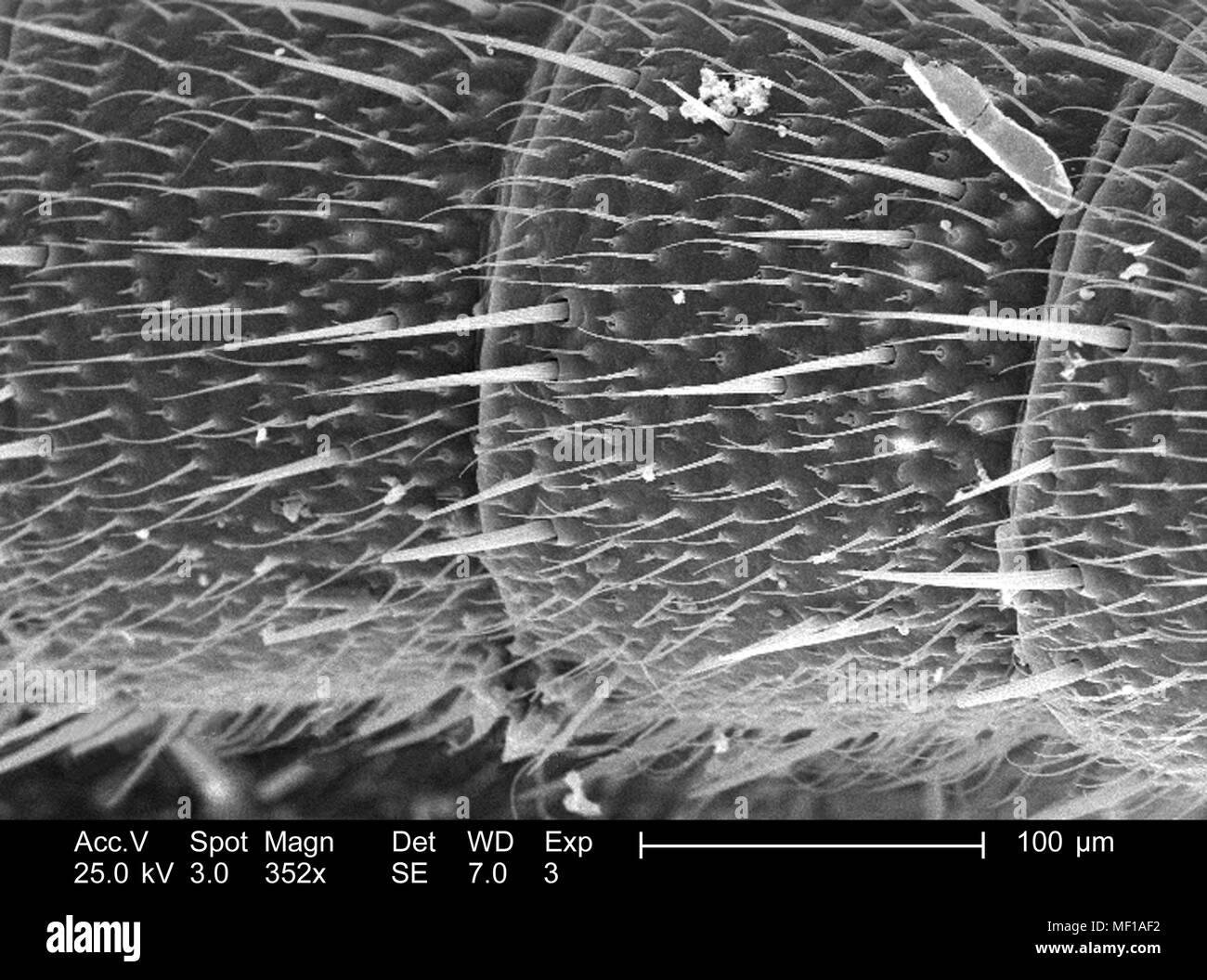 Ultrastrukturforschung Details und sensorischen Haare (setae) einer Libelle Antenne, in der 352 x dargestellten vergrößerten Rasterelektronenmikroskopische (SEM) Bild, 2005. Mit freundlicher Seuchenkontrollzentren (CDC)/Janice Haney Carr, Connie Blumen. () Stockfoto