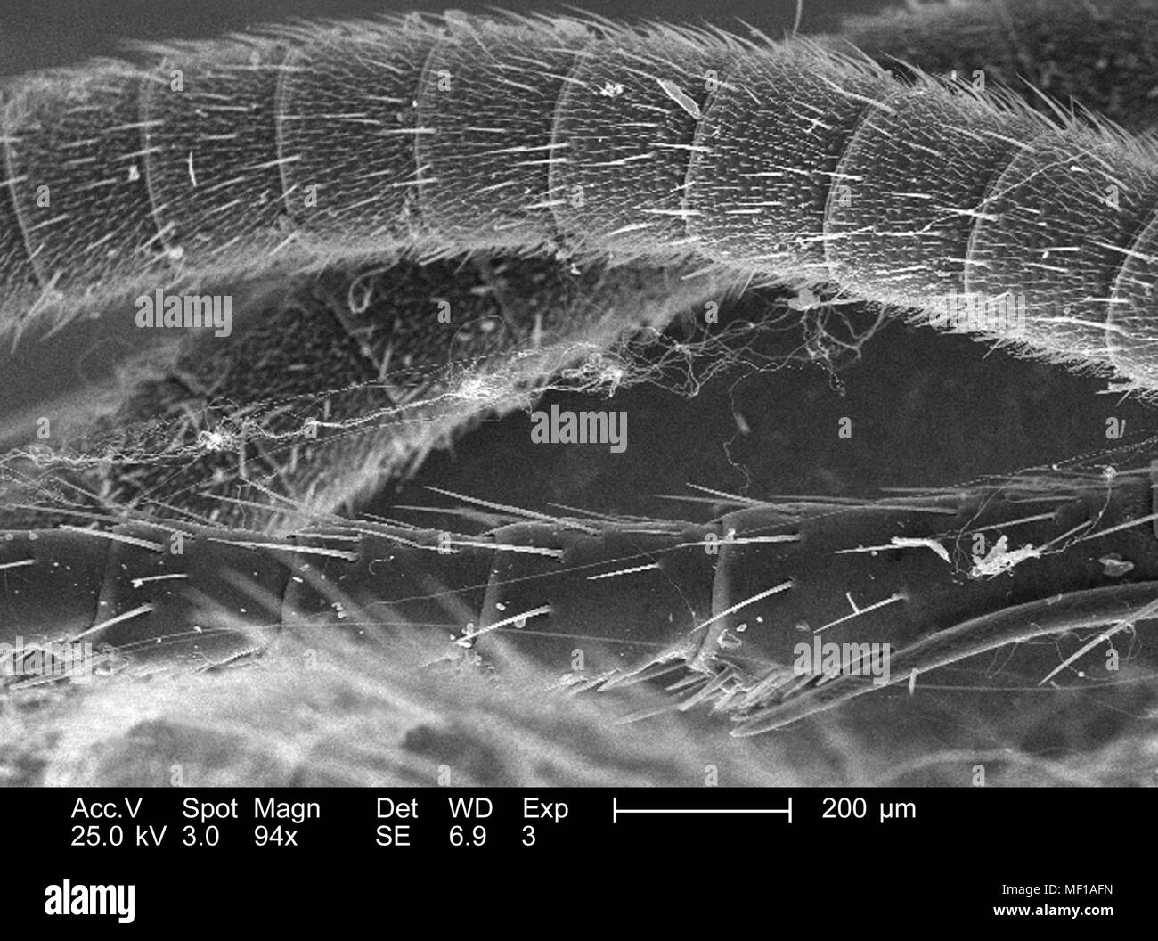 Die strukturellen Details eines Dragonfly Antenne, in den 94 dargestellten x vergrößert Rasterelektronenmikroskopische (SEM) Bild, 2005. Mit freundlicher Seuchenkontrollzentren (CDC)/Janice Haney Carr, Connie Blumen. () Stockfoto