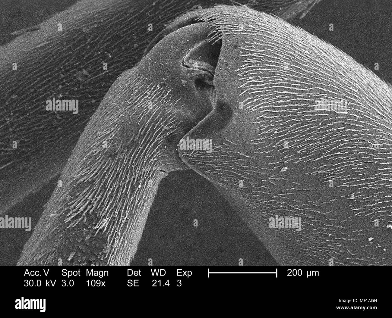Nicht identifizierte Wespe Bein beschichtet mit sensorischen Haare (setae), in der 109 x vergrößert dargestellt Rasterelektronenmikroskopische (SEM) Bild, 2005. Mit freundlicher Seuchenkontrollzentren (CDC)/Janice Haney Carr. () Stockfoto