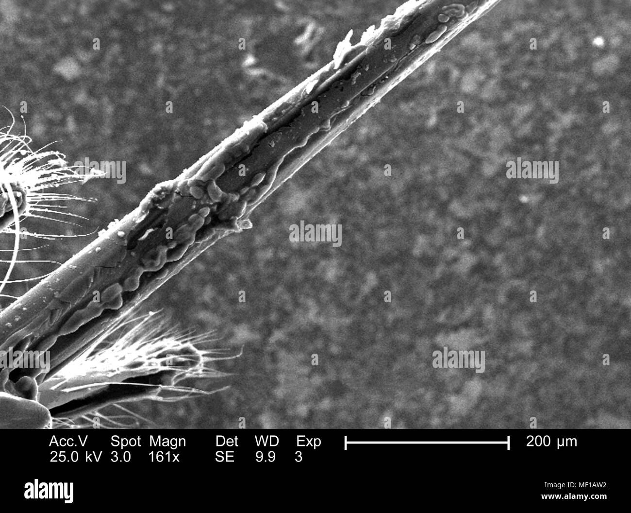 Ultrastrukturforschung morphologische Details eines nicht identifizierten hymenopteran Insekt stinger Apparat, in der 161 x vergrößert Rasterelektronenmikroskopische (SEM) Bild 2005 dargestellt. Mit freundlicher Seuchenkontrollzentren (CDC)/Janice Haney Carr. () Stockfoto