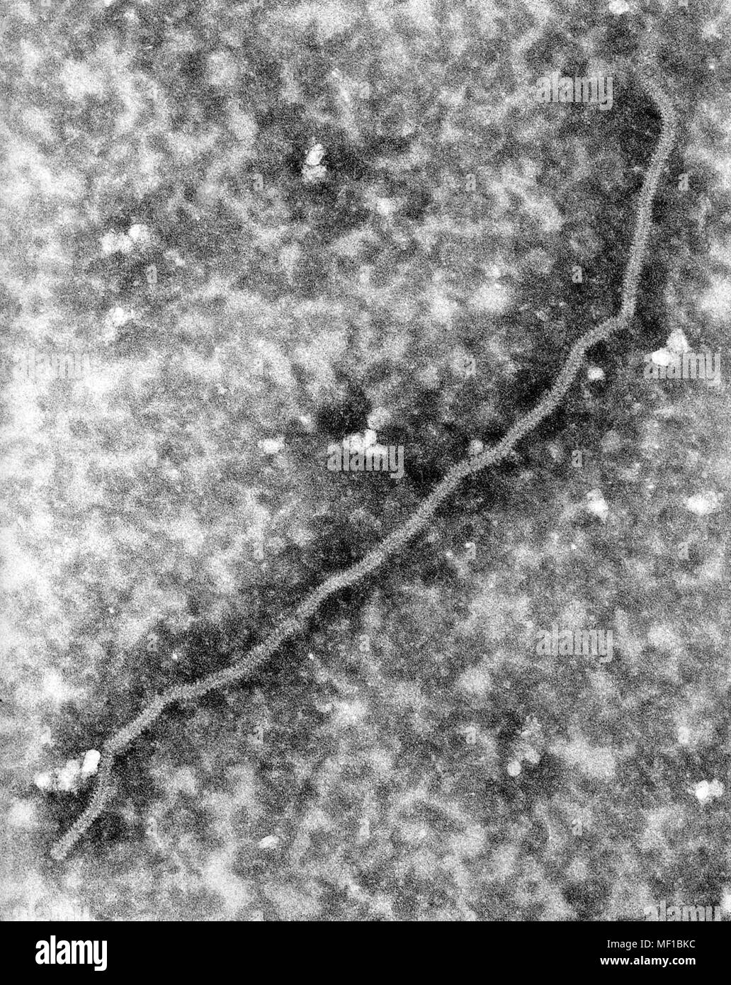 Ultrastrukturforschung Details einer Nipah Virus nucleocapsid, in der 168.000 x vergrößert Transmissions-elektronenmikroskop micrographic (TEM) Bild, 1999 aufgedeckt. Mit freundlicher Seuchenkontrollzentren (CDC)/C. S. Goldsmith, S. Rota. () Stockfoto