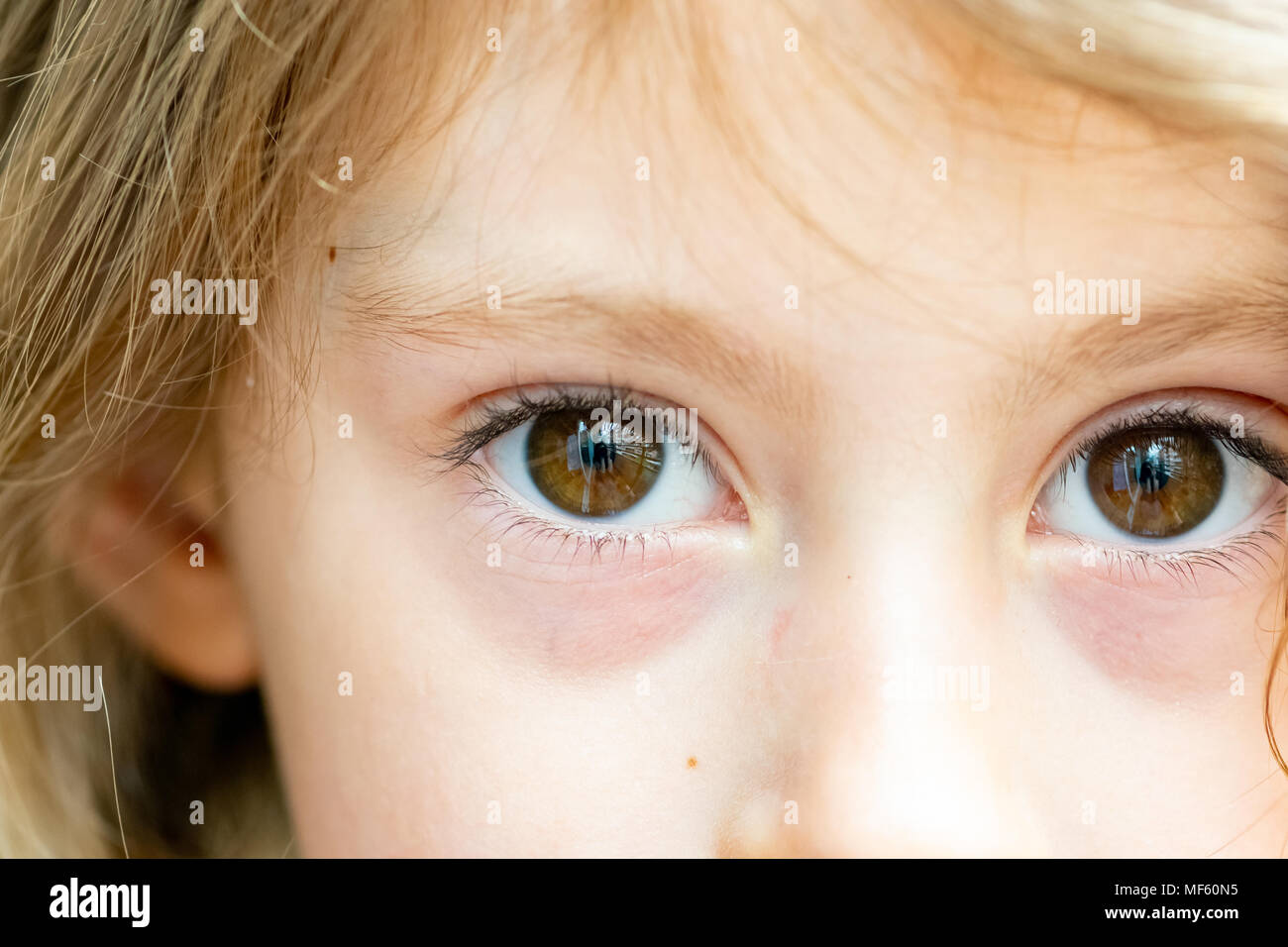 In der Nähe von Augen blond kaukasische Mädchen in die Kamera schaut Stockfoto