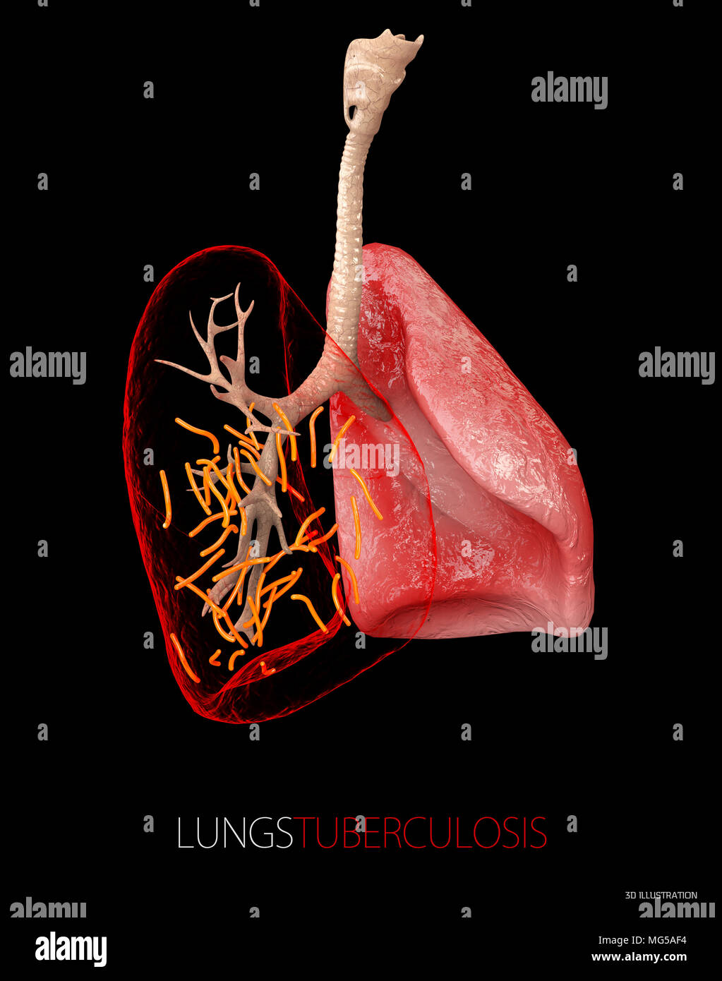Bakterium Mycobacterium tuberculosis, der Erreger der Tuberkulose, 3D-Darstellung. Stockfoto
