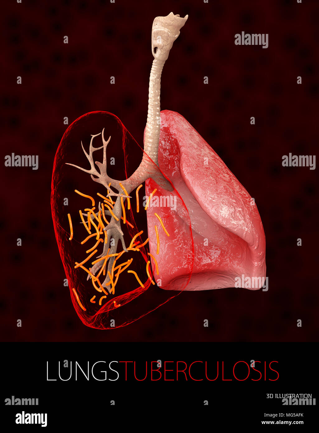 Bakterium Mycobacterium tuberculosis, der Erreger der Tuberkulose, 3D-Darstellung. Stockfoto