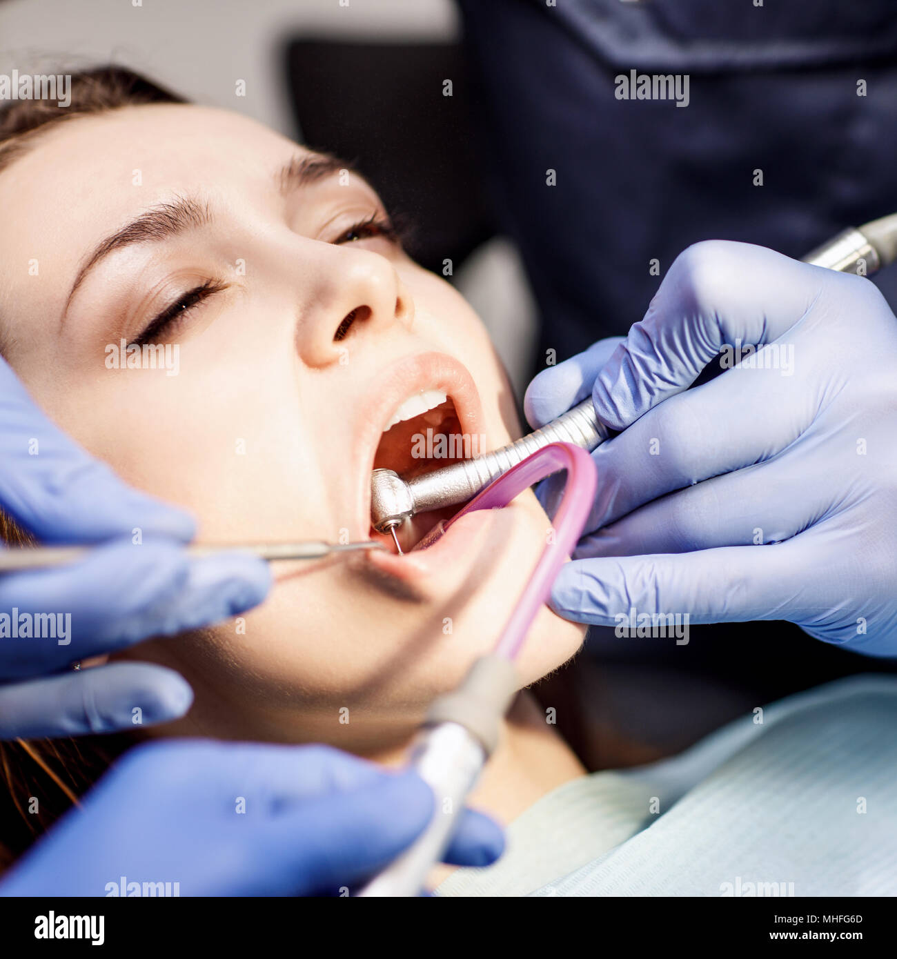 Männliche Zahnarzt Zähne behandeln zu junge Frau, die Patienten in der Klinik. Stockfoto