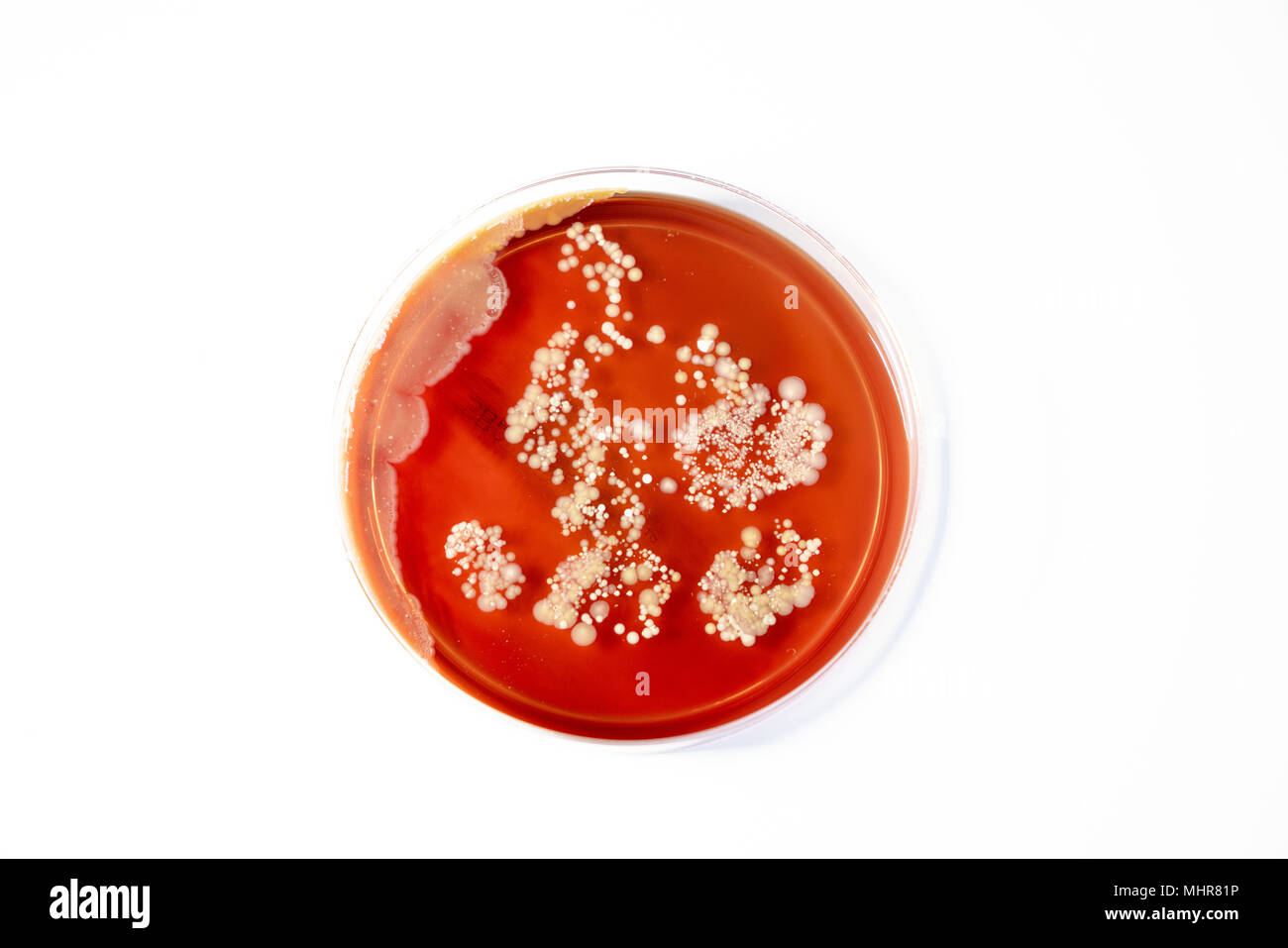 Petrischale mit Kolonien von Bakterien Stockfoto