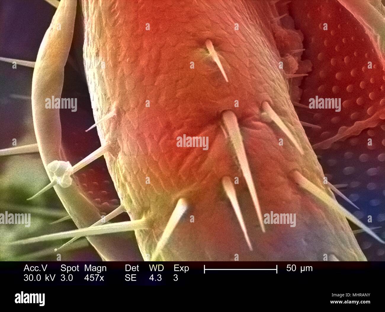 Exoskeletal Oberfläche eines nicht identifizierten Roach, in der 457 x vergrößert dargestellt Rasterelektronenmikroskopische (SEM) Bild, 2005. Mit freundlicher Seuchenkontrollzentren (CDC)/Janice Haney Carr. Hinweis: Das Bild hat digital über ein modernes Prozess eingefärbt worden. Farben können nicht wissenschaftlich korrekt sein. () Stockfoto