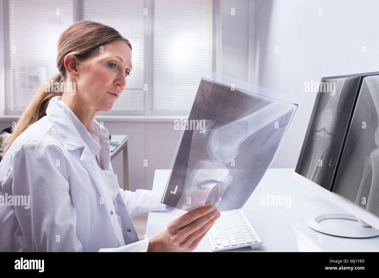 Reife weibliche Arzt untersuchen Knie X-ray In der Klinik Stockfoto Reife weibliche Arzt untersuchen Knie X-ray In der Klinik Stockfoto