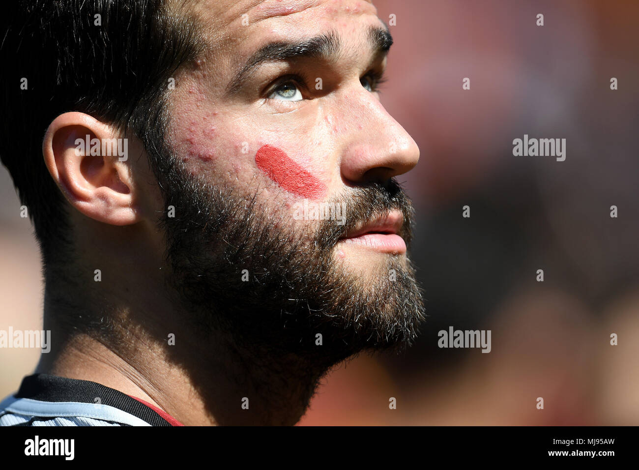 Alisson Becker mit roter Markierung auf dem Gesicht für die Kampagne gegen Gewalt gegen Frauen. Segno rosso sul viso Campagna contro La violenza Sulle donn Stockfoto