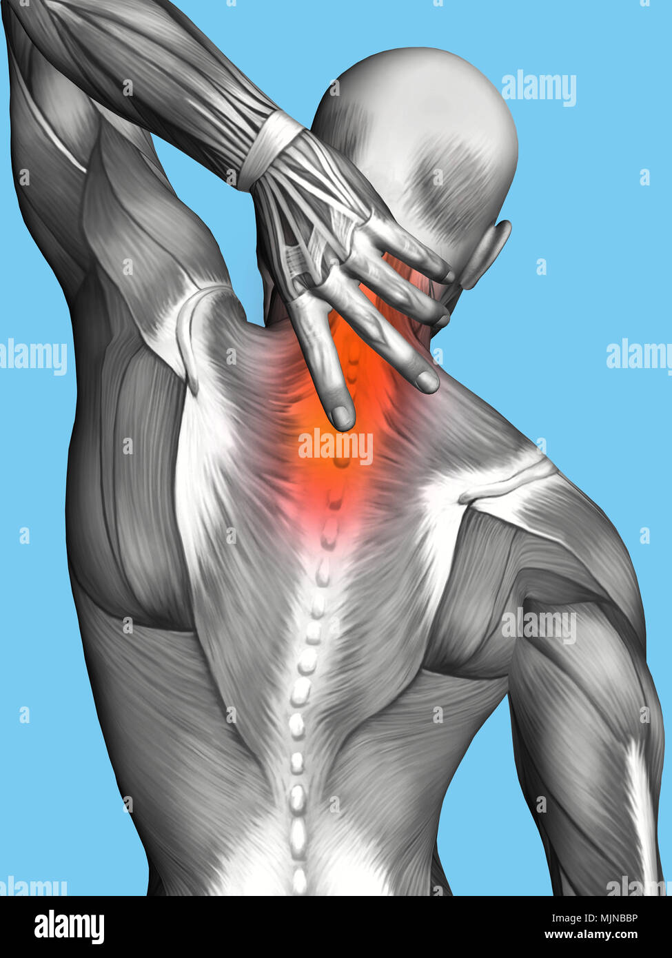 Anatomie der Männlichen mit Schmerzen im oberen Rücken Stockfoto