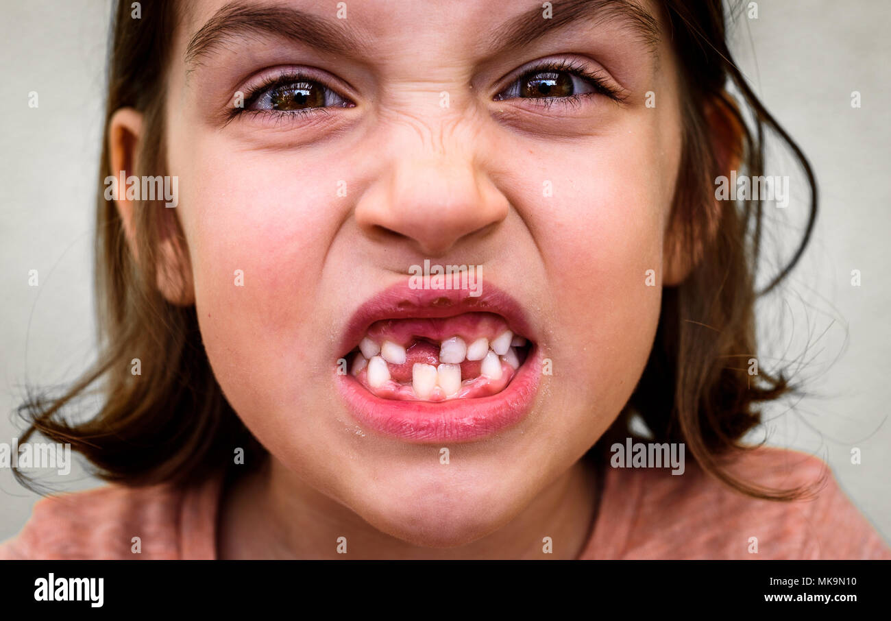 Zahnloses kind Fotos und Bildmaterial in hoher Auflösung Alamy