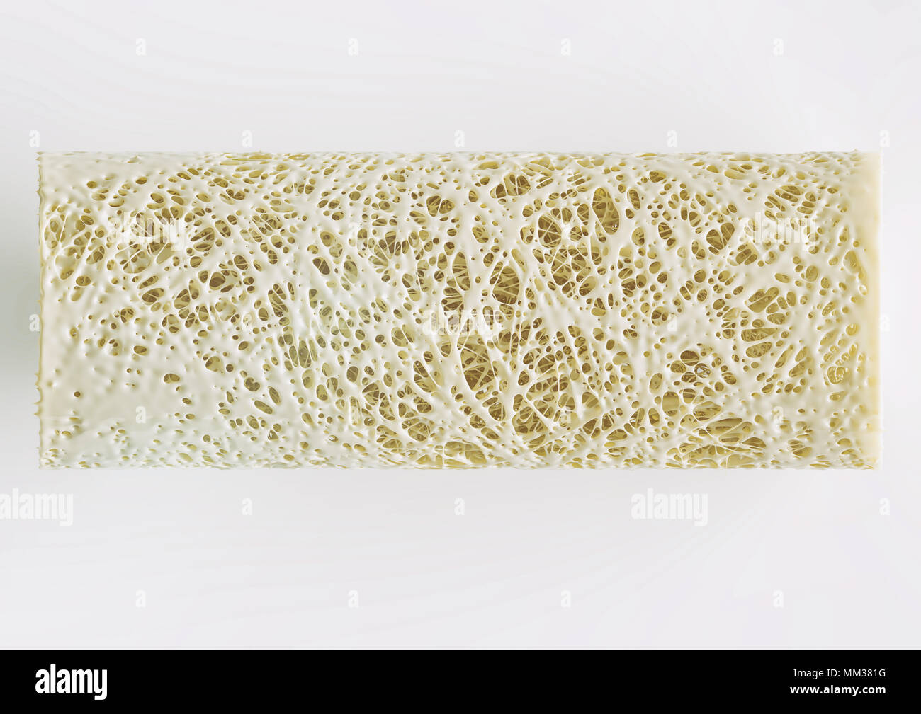 Querschnitt einer fortgeschrittenen Osteoporose - hohe Details - Stufe 4 - 3D-Rendering Stockfoto
