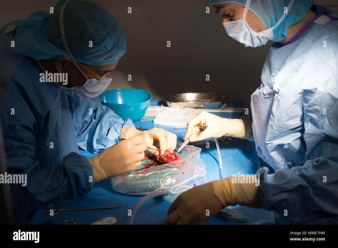Nierentransplantation Stockfoto