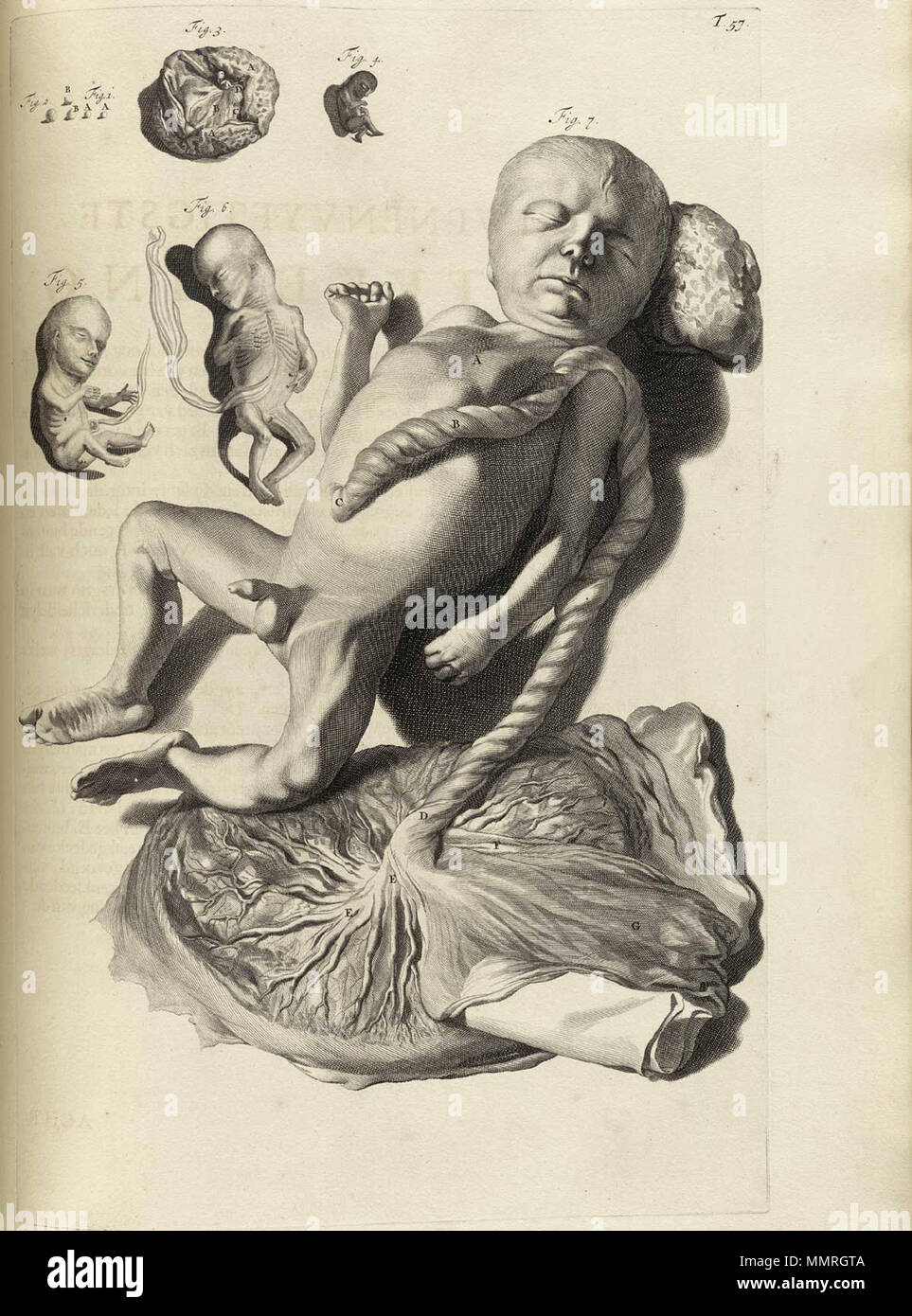 . Govard Bidloo, (1649-1713): Ontleding des menschelyken lichaams Amsterdam, 1690. (= niederländische Sprache Edition von Anatomia Humani Corporis, 1685). Gerard de Lairesse (Zeichnungen), Abraham Blooteling, Pieter Stevens van Gunst (GRAVEURE)/Scans von NLM Bidloo Ontleding 1690 57 Stockfoto