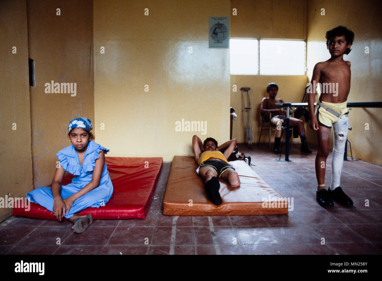 Managua, Nicaragua, Juli 1981; Erwachsene und Jugendliche im Krieg verletzt werden an diesem Prothetik Klinik behandelt. Stockfoto