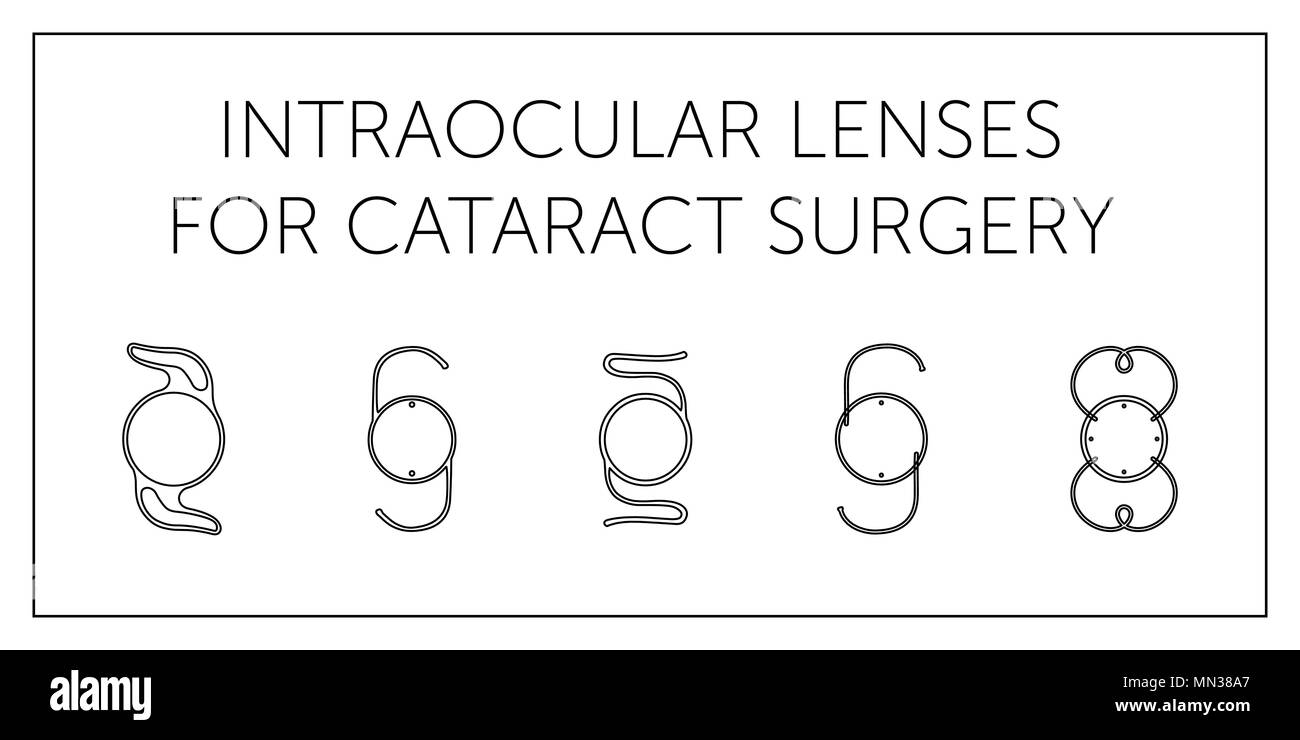 Schematische der Intraokularlinsen auf weißem Hintergrund Stock Vektor