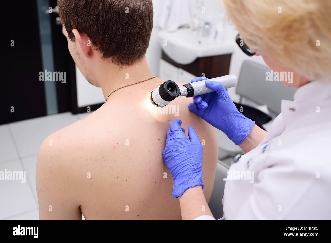 Der Arzt Hautarzt untersucht Muttermal und Muttermale des Patienten mit einem dermatoskop Stockfoto
