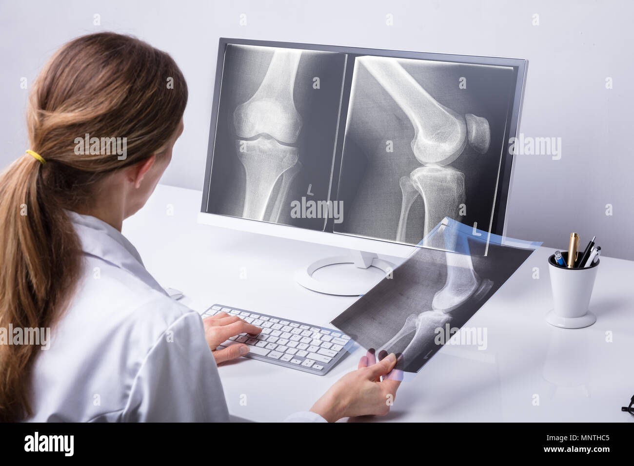 Reife weibliche Arzt untersuchen Knie X-ray In der Klinik Stockfoto Reife weibliche Arzt untersuchen Knie X-ray In der Klinik Stockfoto