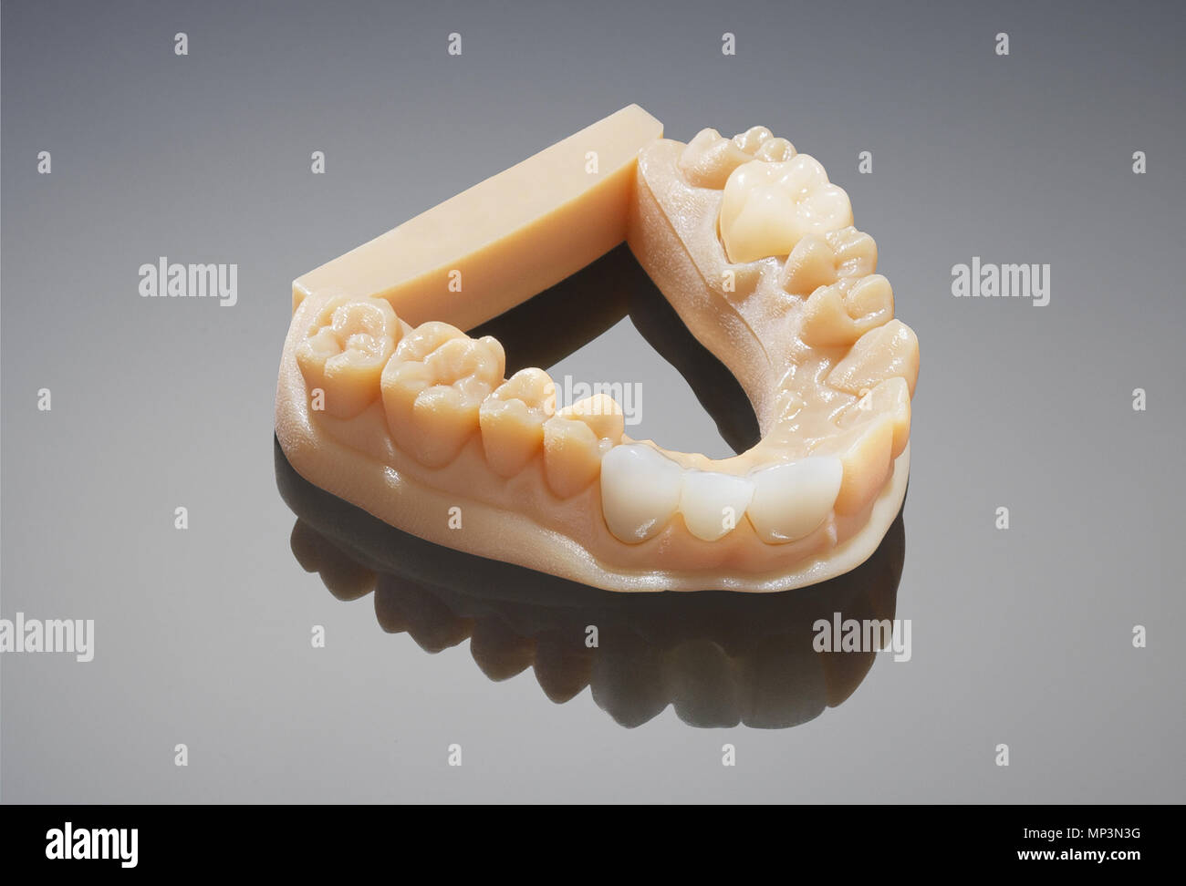 Zahnmedizinische und Kieferorthopädische 3D-Zähne Modell Stockfoto