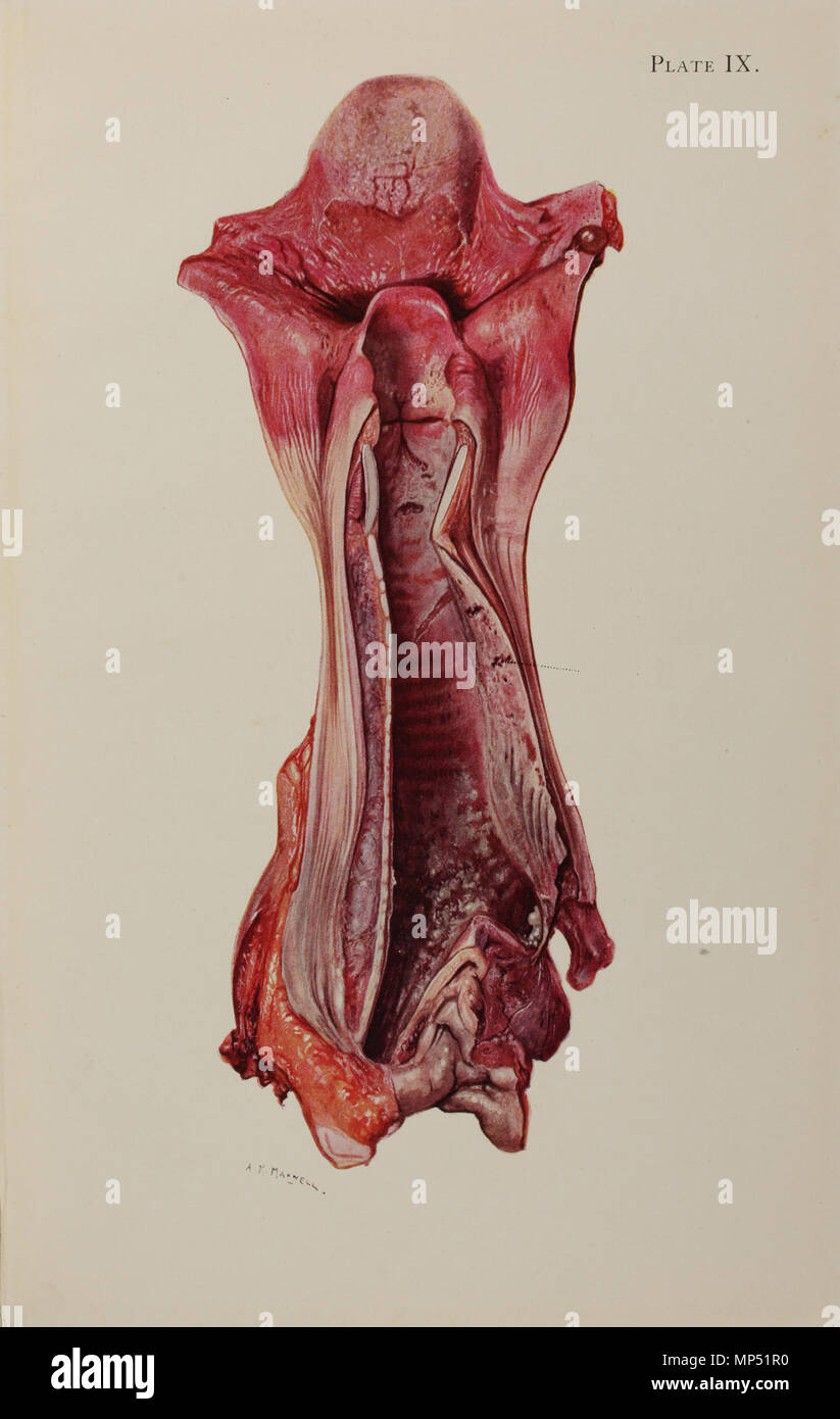 Platte IX. Englisch: Platte IX von einem Atlas der Gasvergiftung durch das amerikanische rote Kreuz und die medizinische Forschung (American Red Cross, 1918). Platte Titel: 'Ulzerationen der Trachea durch Senfgas." Text beginnt: "Das charakteristische Merkmal ist die Ablösung von der trachealen Schleimhaut. Die Rötungen auf der Unterseite der Zunge und des Rachens mit einer scharfen Abgrenzung, wo die Speiseröhre eindringen, um die giftigen Dämpfe abgelehnt hat, wird auch mit Chlor und andere reizgase gesehen. ... "Das Amerikanische Rote Kreuz veröffentlicht dieser Leitfaden für die American Expeditionary Force im Ersten Weltkrieg, sometim Stockfoto