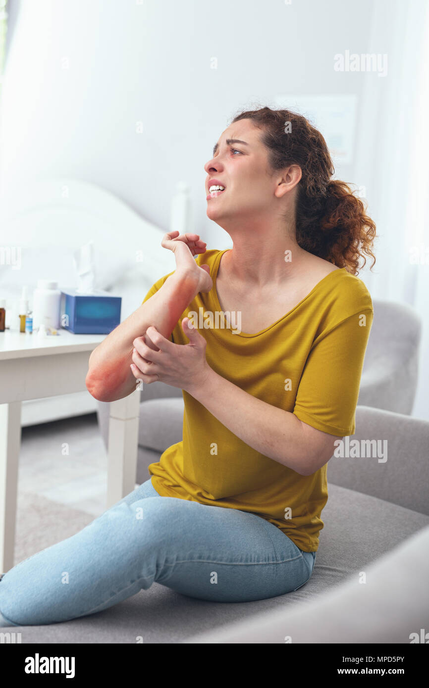 Jugendliche Dame Leiden von einem Hautausschlag Stockfoto