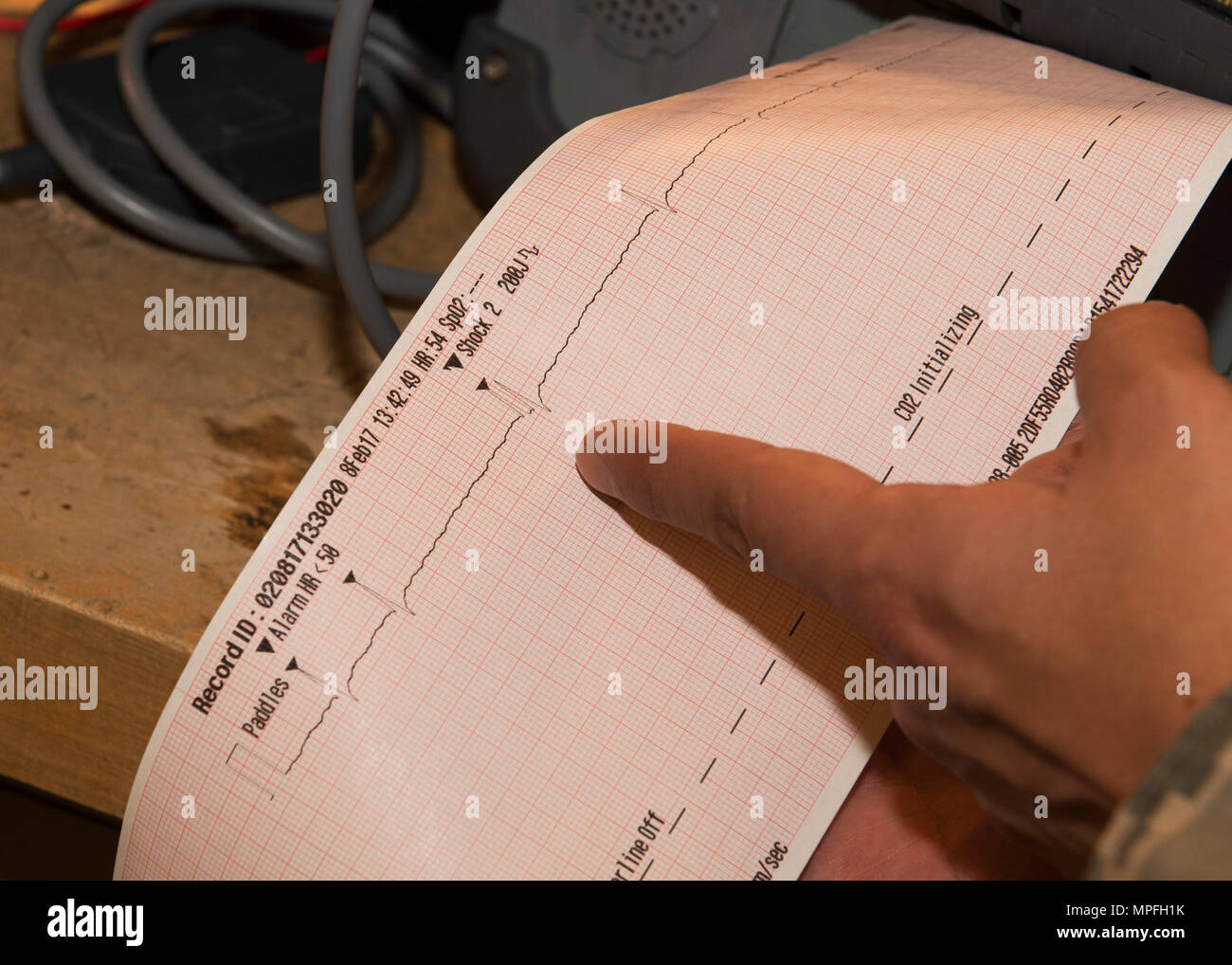 Staff Sgt. Andres Guevara, 5. Medizinische Unterstützung Squadron biomedizinische Geräte Handwerker, liest die Ergebnisse eines Defibrillators Test am 5. medizinische Gruppe Klinik in Minot Air Force Base, N.D., 8. Februar, 2017. Der Defibrillator prüft den Herzrhythmus eines Patienten für ungewöhnliche beats-per-minute und gilt Stromschlag, wenn sie benötigt werden. (U.S. Air Force Foto/Airman 1st Class Alyssa M. Akers) Stockfoto