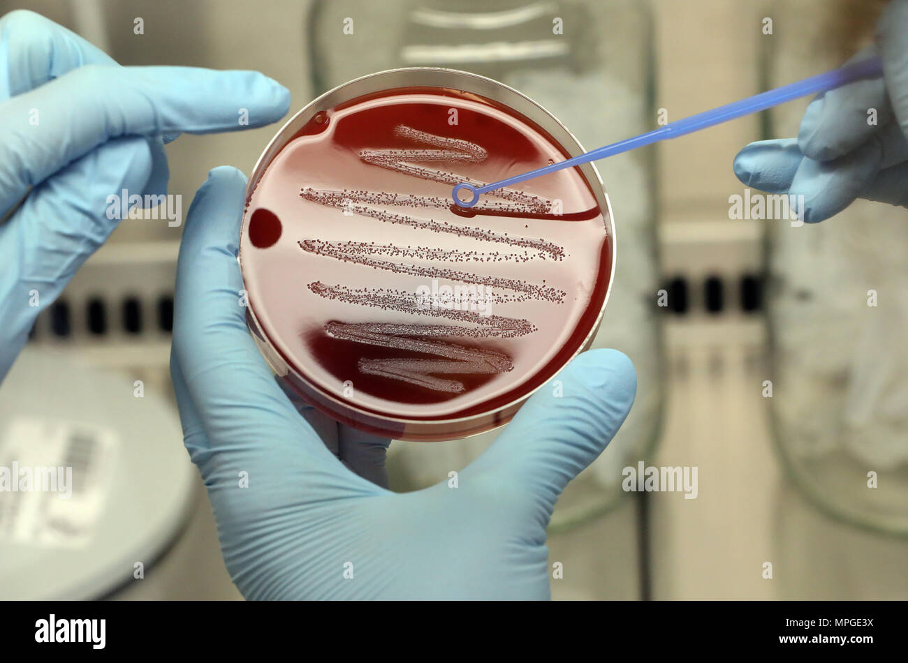 18. Mai 2018, Deutschland, Berlin: ein Biologe am Max-Planck-Institut für Infektionsbiologie bereitet eine bakterielle Kolonie der Stamm Streptococcus pyogenes auf einem Blut Agarplatte. Die aktuelle Forschung konzentriert sich auf das Finden von regulatorischen Mechanismen zur Infektion und Immunität in Bakterien. Wissenschaftler sind vor allem in der Rolle der RNA und bestimmte Proteine, die zellulären Prozesse der Kontrolle interessiert. Ziel ist es, diese Erkenntnisse in neue medizinische Entwicklungen zu integrieren, wie es der Fall mit Crispr-Cas 9. Foto: Wolfgang Kumm/dpa Stockfoto