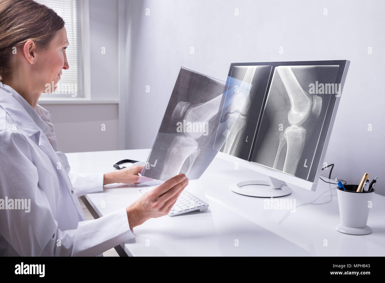 Reife weibliche Arzt untersuchen Knie X-ray In der Klinik Stockfoto Reife weibliche Arzt untersuchen Knie X-ray In der Klinik Stockfoto