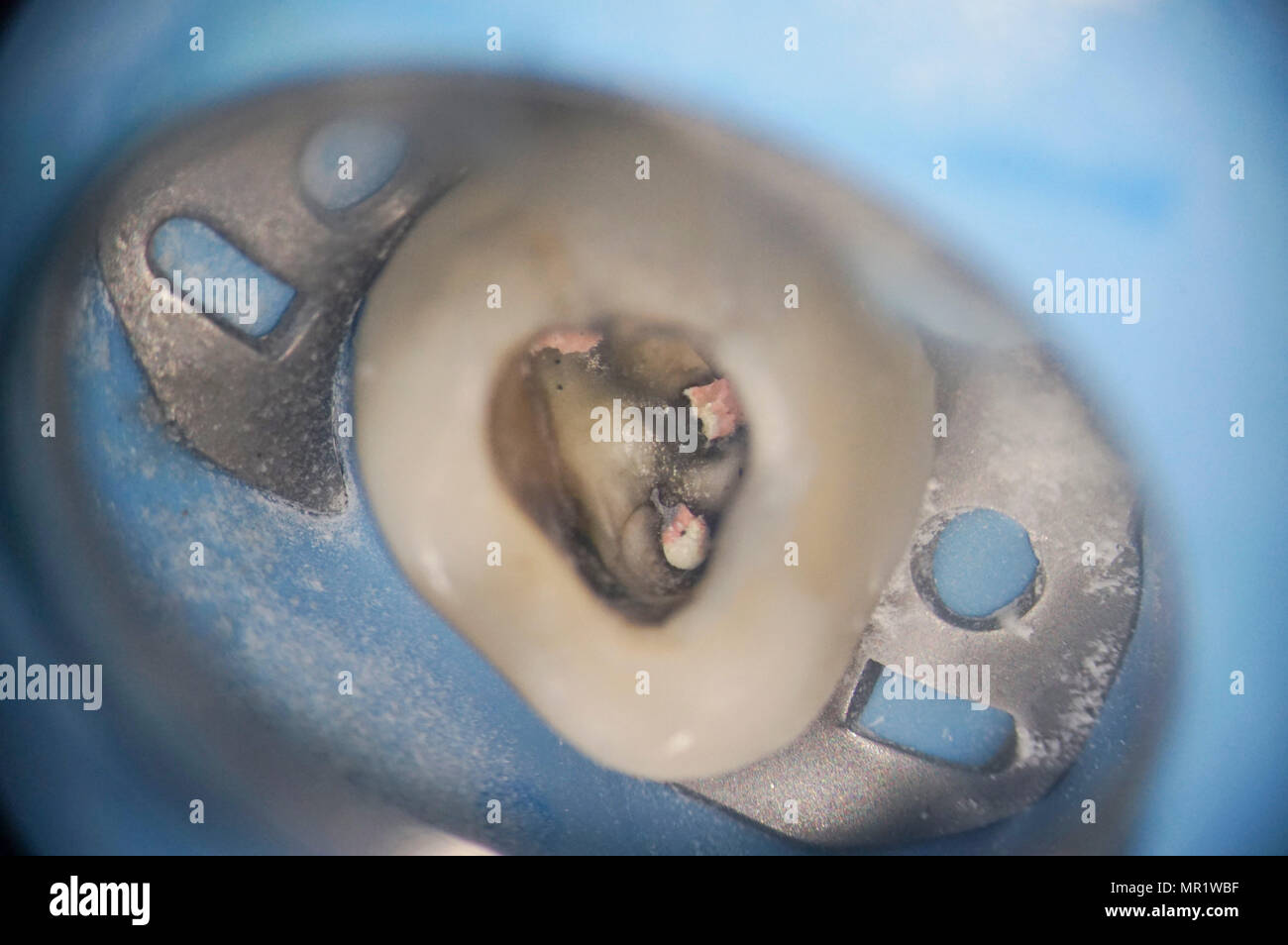 Makro in das Innere eines Zahnes mit Wurzelkanäle Stockfoto