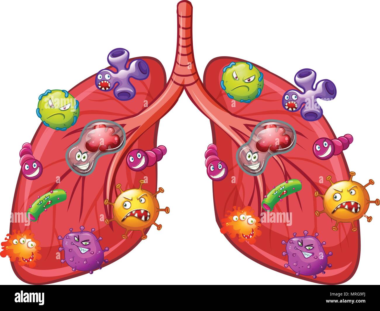 Ein Vektor der Lunge Bakterien Abbildung Stock Vektor