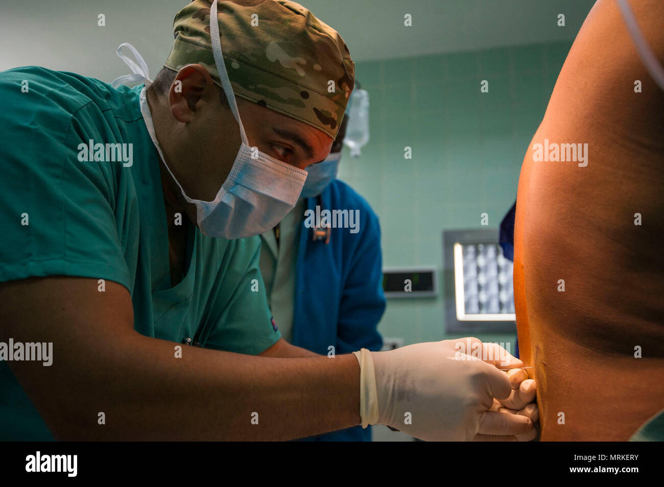 Us-Armee Maj. Fernando Lopez, eine Krankenschwester Anästhesist, verwaltet Spinalanästhesie vor der Achillessehnenruptur Chirurgie während der Medizinischen Readiness Training Übung 17-4 am Krankenhaus D'Anweisung des Armees in Libreville, Gabun, Juni 20. Die gegenseitig vorteilhafte Übung bietet Chancen für die partnered Militärs zur gemeinsamen Nutzung von Best Practices und die medizinische Behandlung zu verbessern. (U.S. Armee Afrika Foto: Staff Sgt. Shejal Pulivarti) Stockfoto