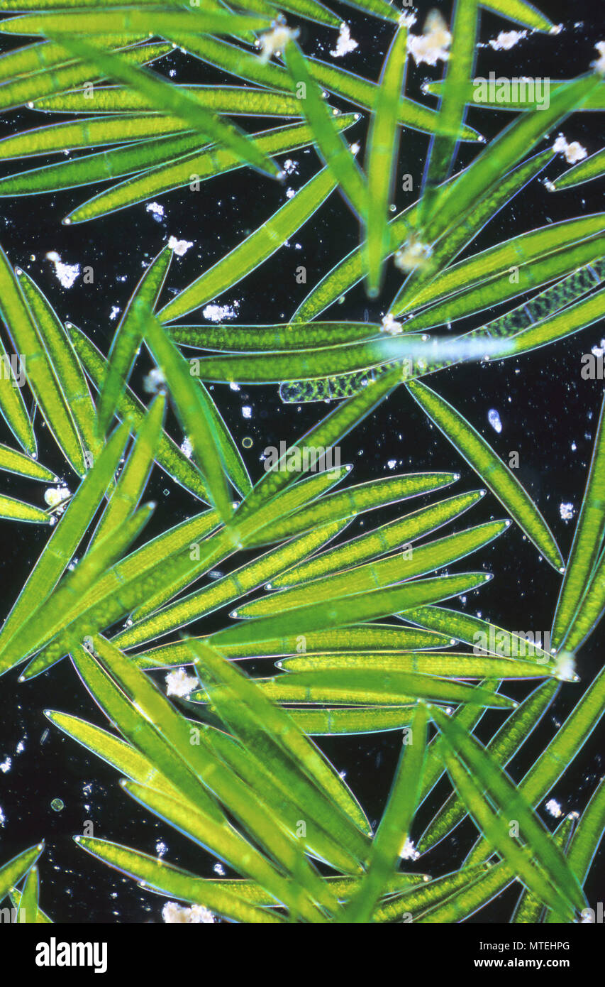 Closterium. Chlorophyta. Algen. Optic micrsocopy Stockfoto