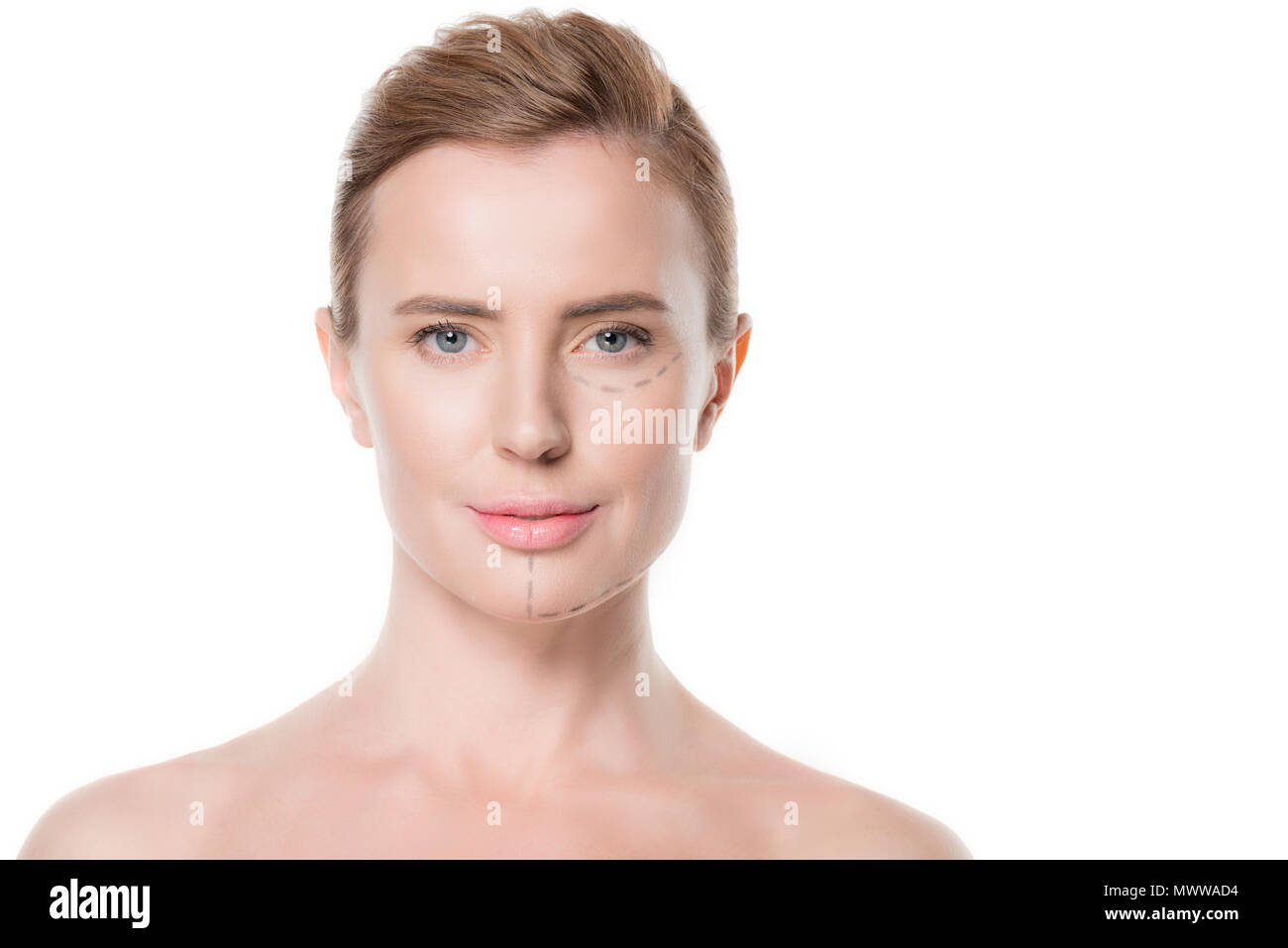 Weibliche mit gemalten Linien auf Gesicht für plastische Chirurgie isoliert auf weißem Stockfoto
