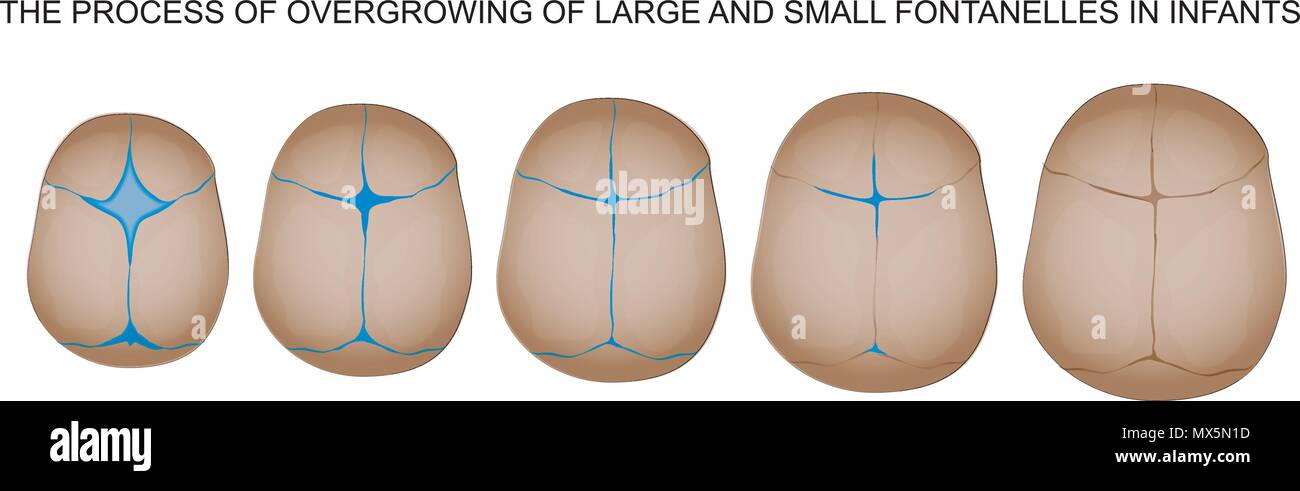 Die Schließung der fontanelle Neugeborenen Stock Vektor