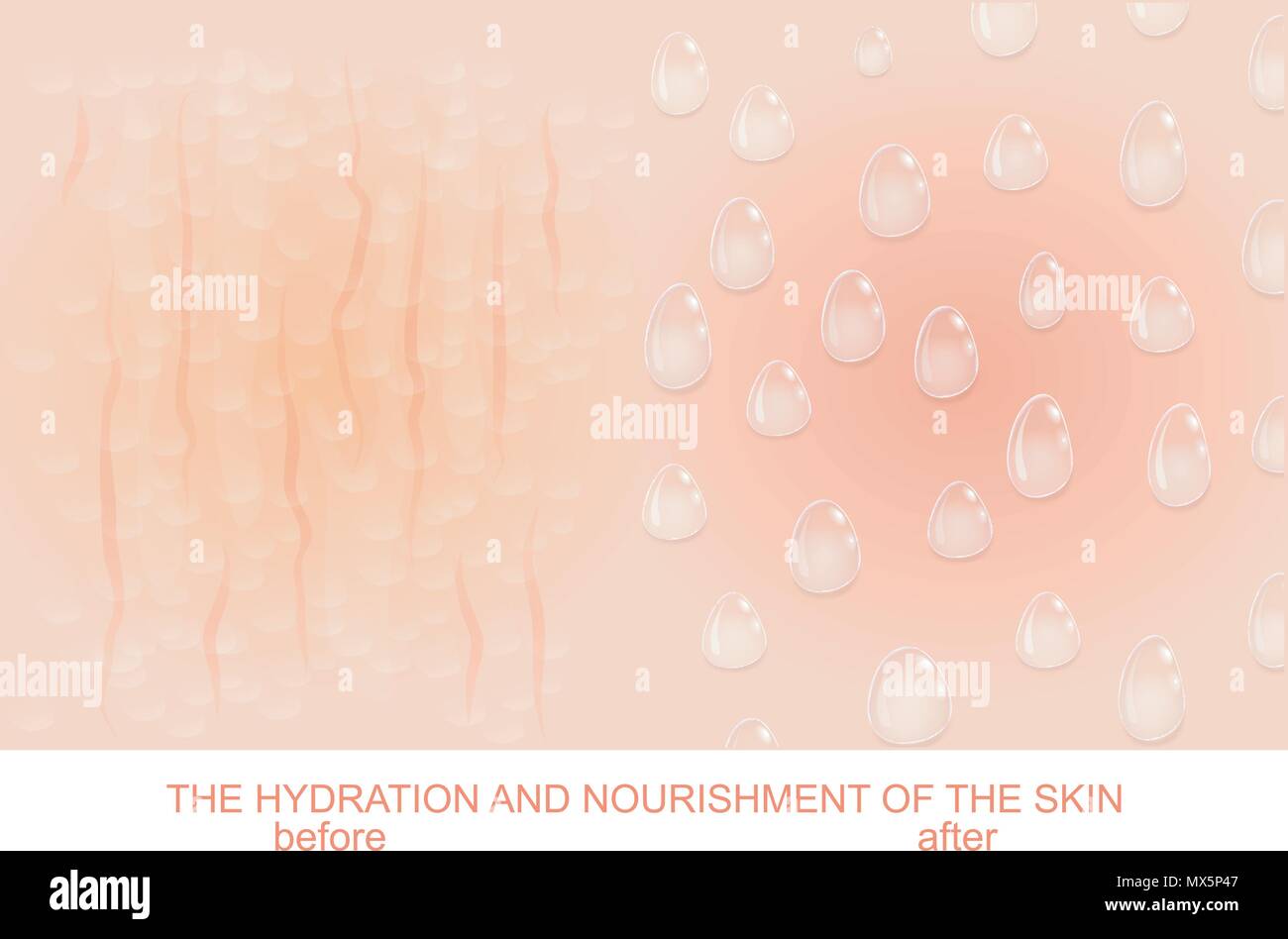 Abbildung nähren und befeuchten die Haut. Trockene Haut vor und nach der Hydratation Stock Vektor