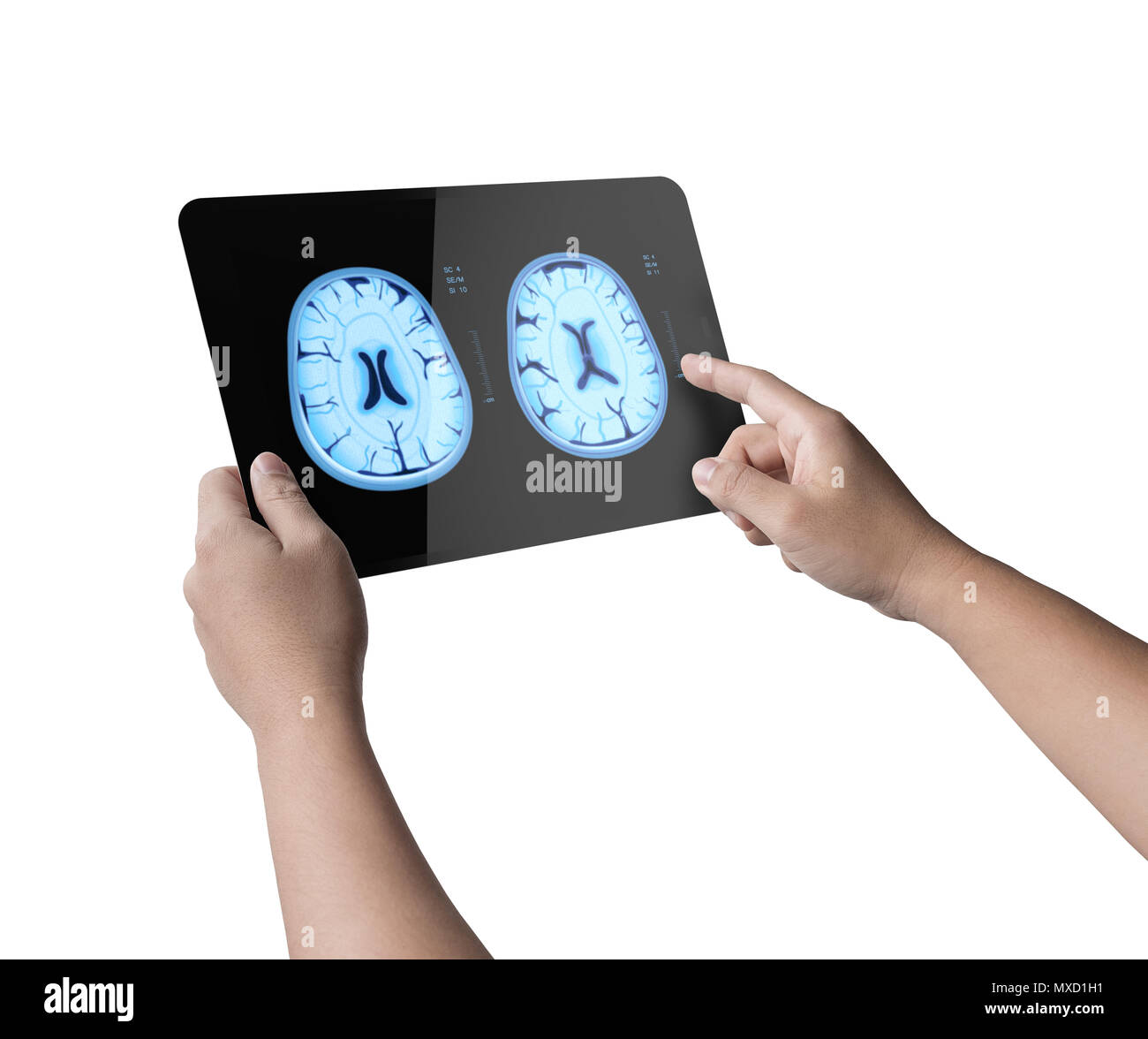 Hand, 3D-Rendering digital tablet Anzeige x-ray Gehirn isoliert auf weißem Stockfoto