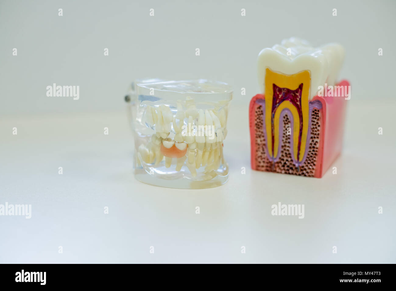 Mundgesundheit, Karies und Zucker zerstört den Zahnschmelz Konzept mit Kunststoff medizinische Modell der Zähne oder Zahnersatz. Zähne Modell für Bildung. Zahnarzt. Kopieren Sie Platz. Zahn Gesundheit Stockfoto