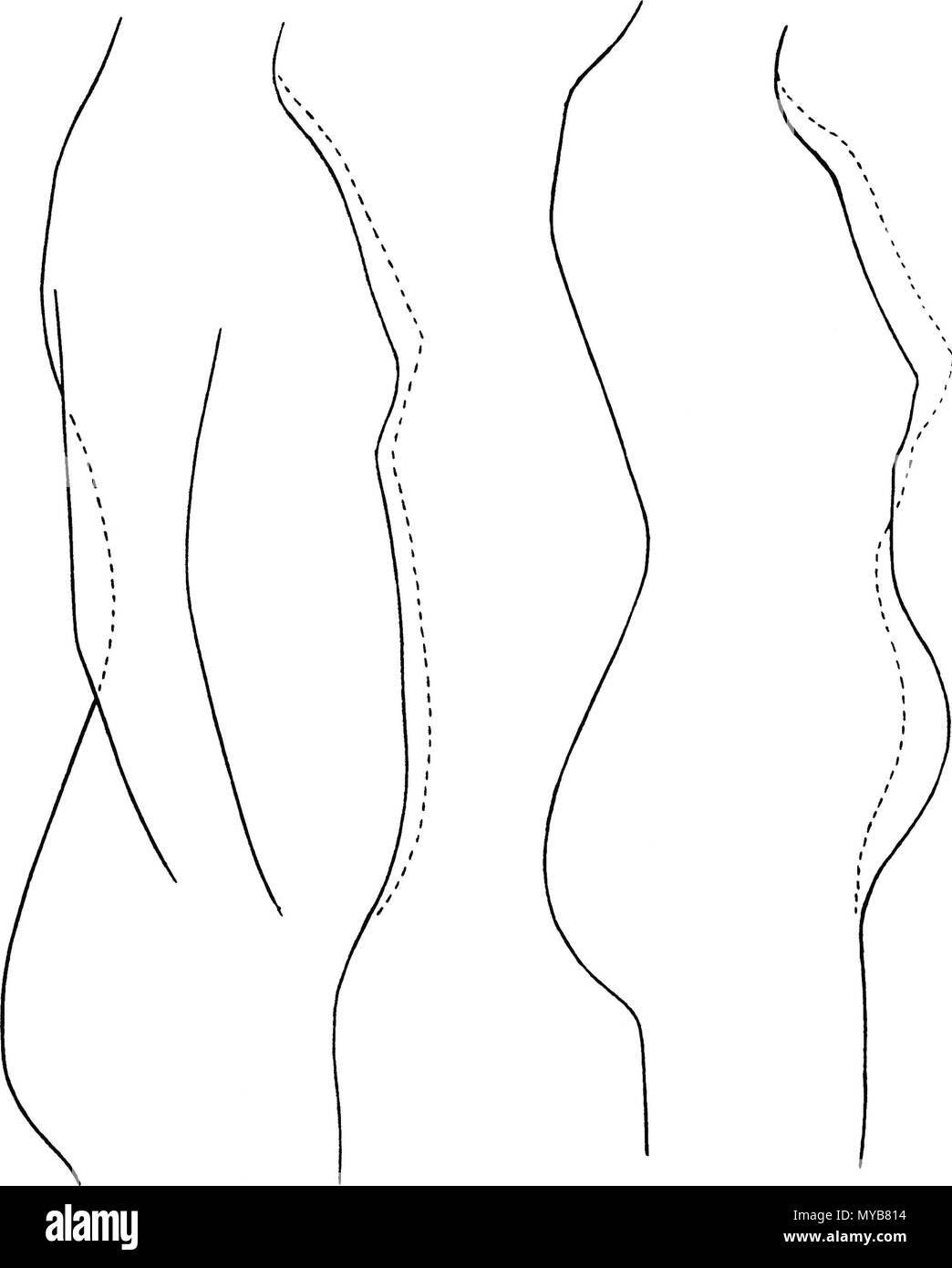 . Englisch: die Atmung des Menschen, und die Atmung ist eine Frau im Korsett. 1910 (Master von 1880 s). Unbekannt 86 Atmung Korsett Stockfoto