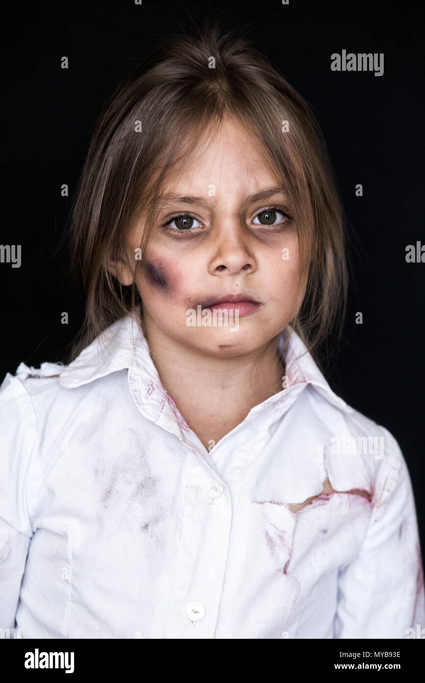 Kindesmissbrauch. Traurig und einsam Mädchen weinen. Verletzte Kind als Opfer von häuslicher Gewalt posing Stockfoto