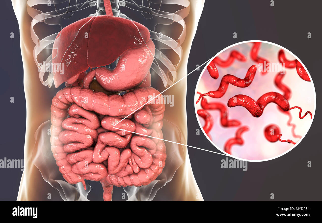 Akute Gastroenteritis Fotos Und Bildmaterial In Hoher Aufl sung Alamy