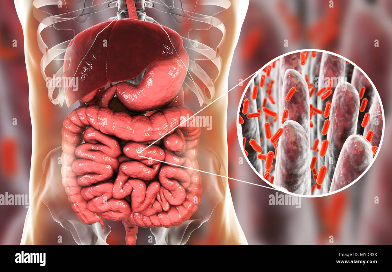 Computer Abbildung: Das menschliche Verdauungssystem und eine Nahaufnahme von Bakterien im Darm gefunden. Stockfoto