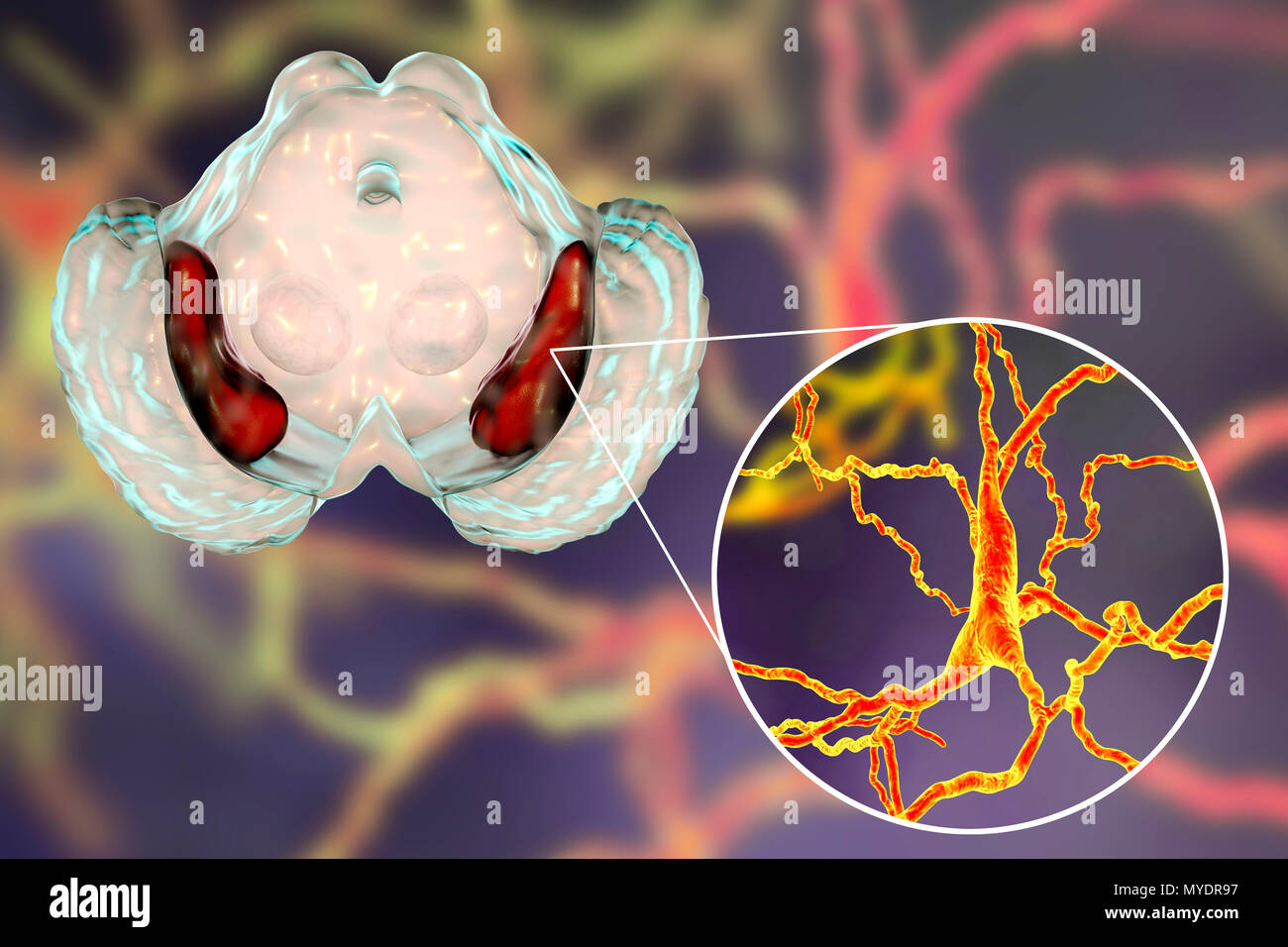 Substantia nigra. Computer zeigt eine gesunde substantia Nigra aus einem menschlichen Gehirn und eine Nahaufnahme von dopaminergen Neuronen in der Substantia nigra gefunden. Die substantia nigra spielt eine wichtige Rolle bei der Belohnung, Sucht, und Bewegung. Degeneration dieser Struktur ist typisch für die Parkinson-krankheit. Stockfoto