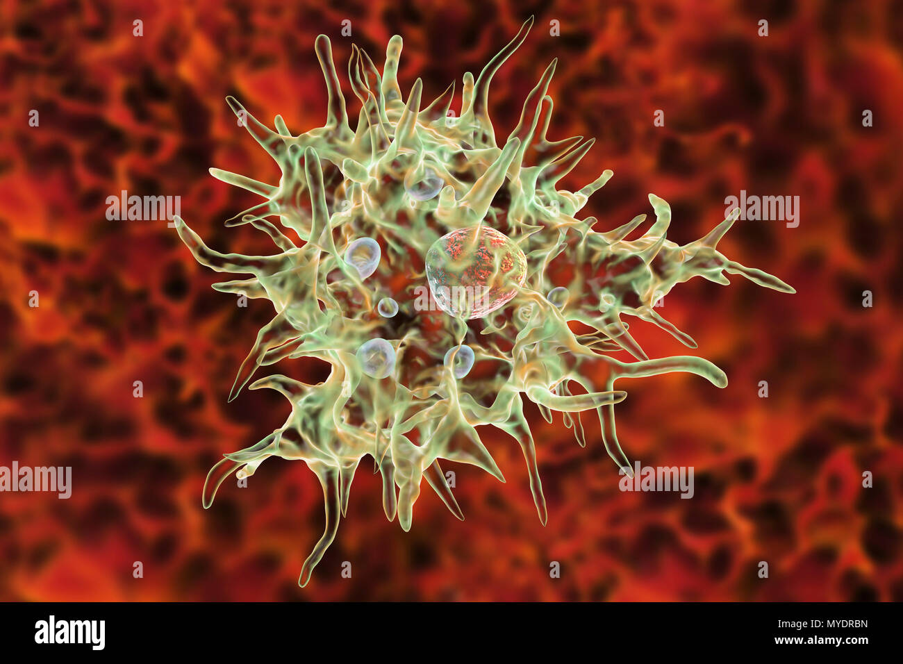 Acanthamoeba castellanii Amöben, computer Abbildung. Dies ist der reproduktiven und ansteckende Stadium des Organismus, oder trophozoite bilden. A. castellanii, einer frei lebenden einzelliger Organismus, ist in allen aquatischen Lebensräume und Boden gefunden. Es kann das Auge verursacht Acanthamoeba Keratitis, eine potentiell blendende Entzündung der Hornhaut infizieren. Obwohl selten, Infektion ist häufiger bei Kontaktlinsenträger. Stockfoto