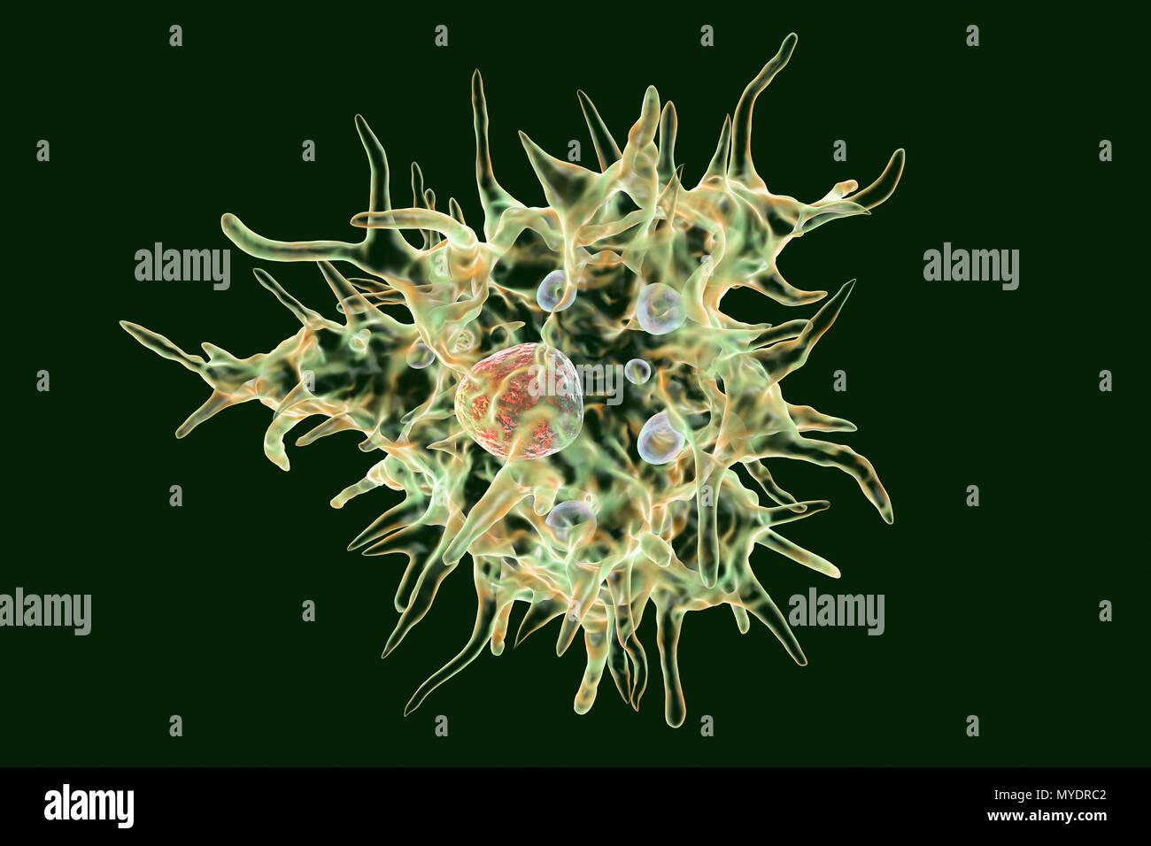 Acanthamoeba castellanii Amöben, computer Abbildung. Dies ist der reproduktiven und ansteckende Stadium des Organismus, oder trophozoite bilden. A. castellanii, einer frei lebenden einzelliger Organismus, ist in allen aquatischen Lebensräume und Boden gefunden. Es kann das Auge verursacht Acanthamoeba Keratitis, eine potentiell blendende Entzündung der Hornhaut infizieren. Obwohl selten, Infektion ist häufiger bei Kontaktlinsenträger. Stockfoto